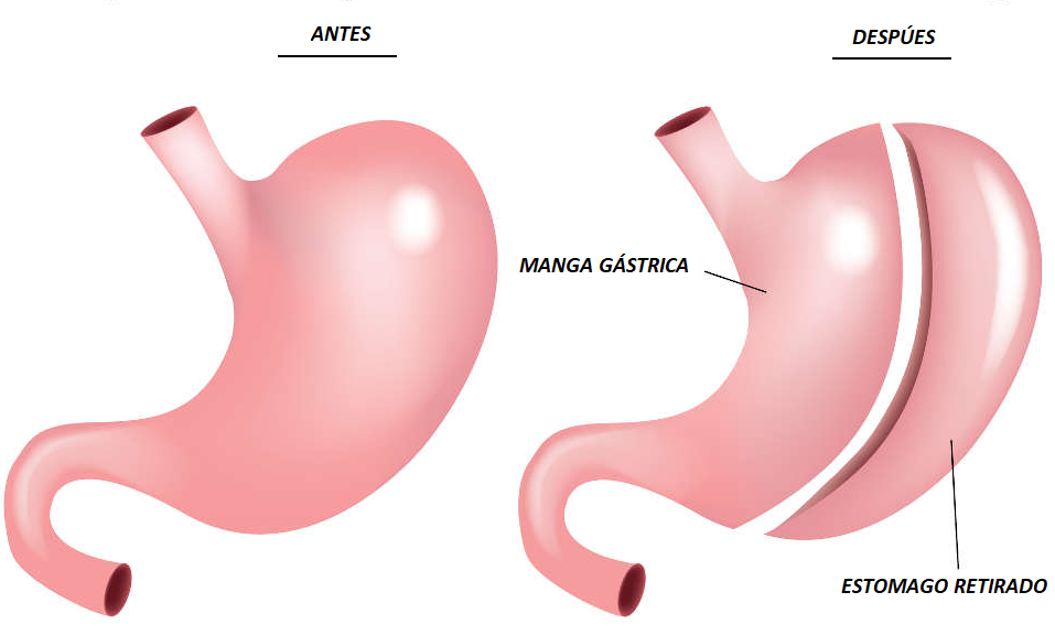 manga gastrica